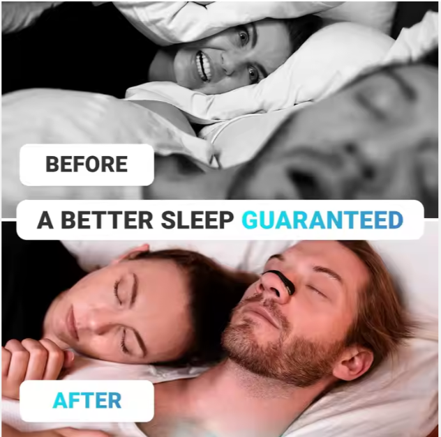 Nasal Dilator (15 Pieces)