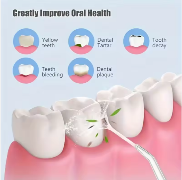 Dental Water Floss